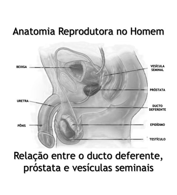 vasectomia-ducto-deferente-próstata-vesículas-seminais