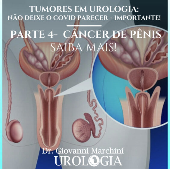tumores-em-urologia-4