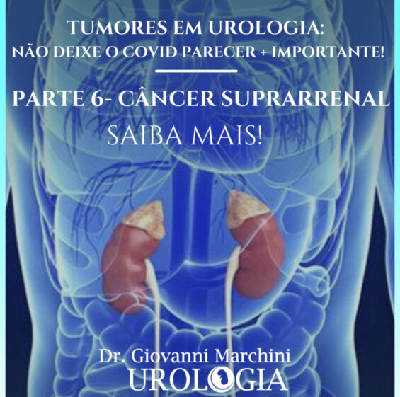 tumores-em-urologia-6