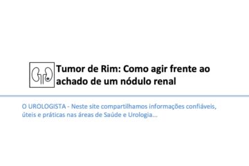 Tumor de Rim: Como agir frente ao achado de um nódulo renal