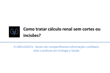 Como tratar cálculo renal sem cortes ou incisões?