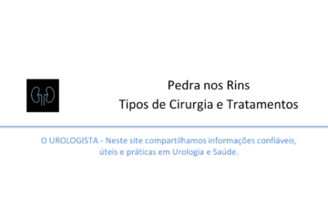 Pedra nos Rins, Tipos de Cirurgia e Tratamentos