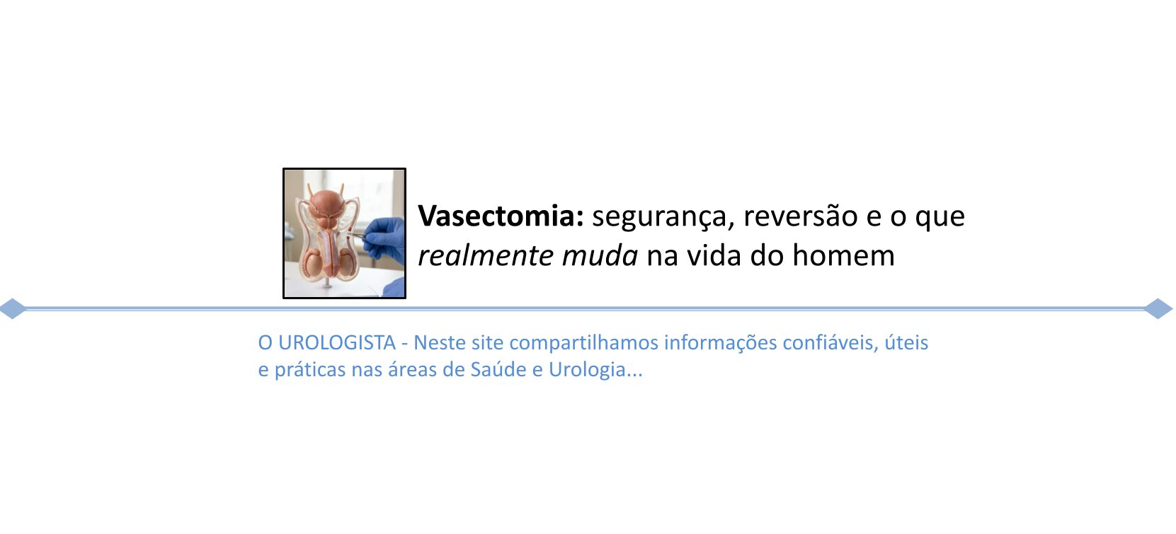 Vasectomia: o que realmente muda na vida do homem